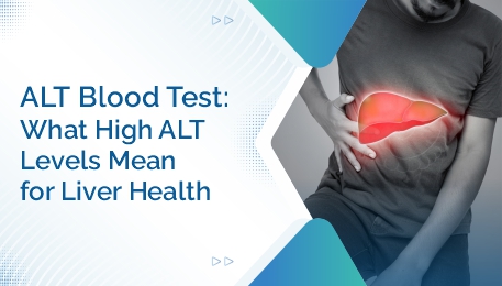 ALT Blood Test What High ALT Levels Mean for Liver Health